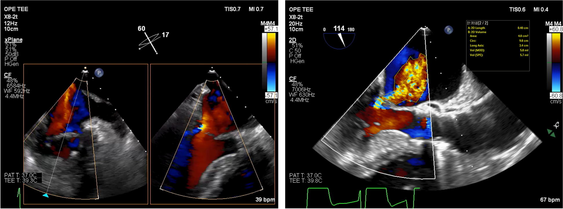 Fig. 3