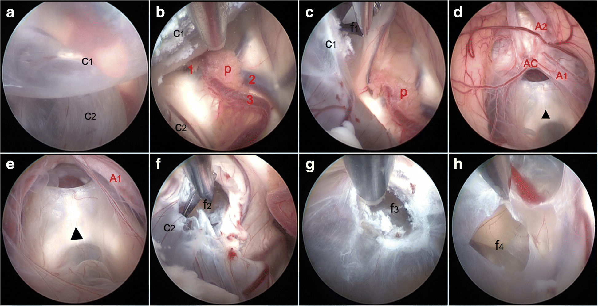 Fig. 2