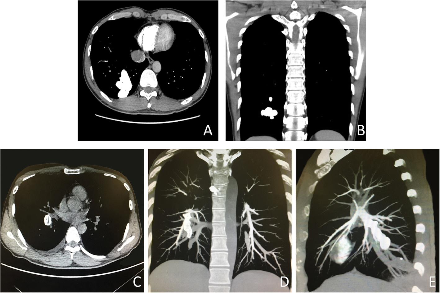 Fig. 2