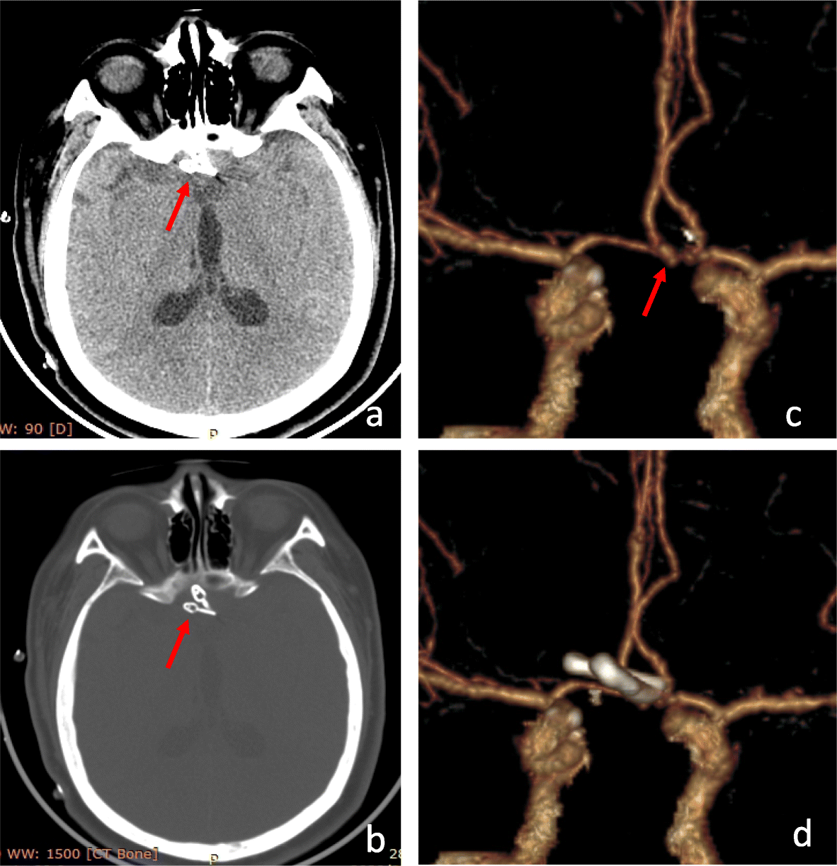 Fig. 5