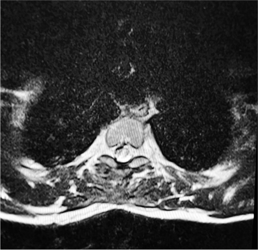 Fig. 11