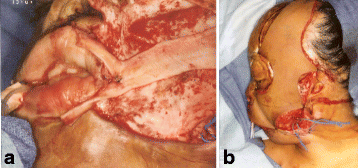 Fig. 10