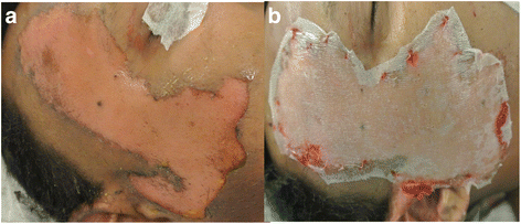 Fig. 5