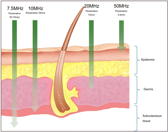 Fig. 6