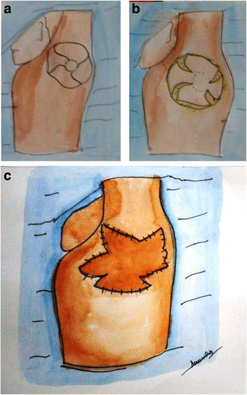 Fig. 4