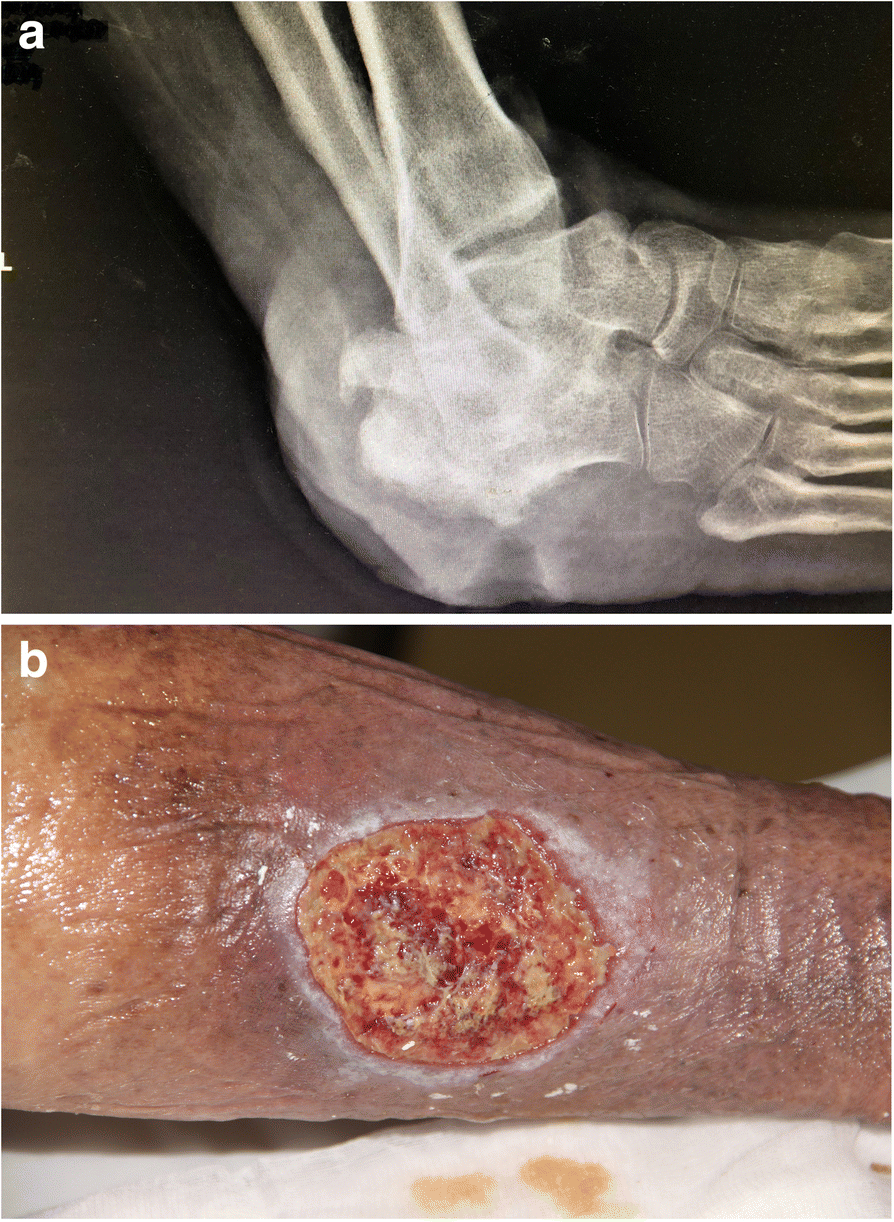 Fig. 3