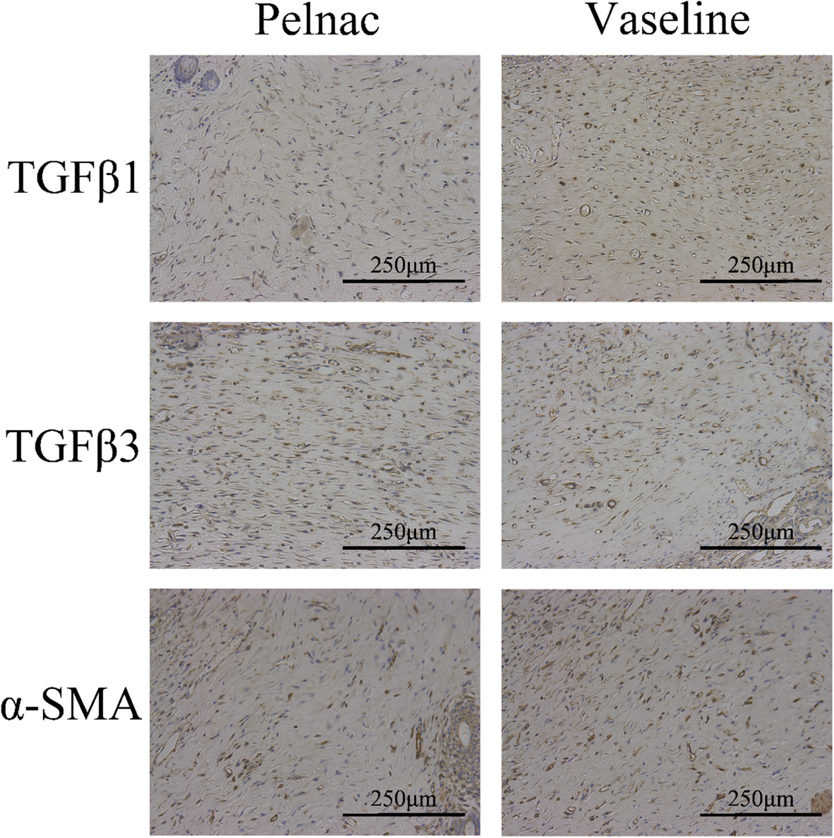 Fig. 11