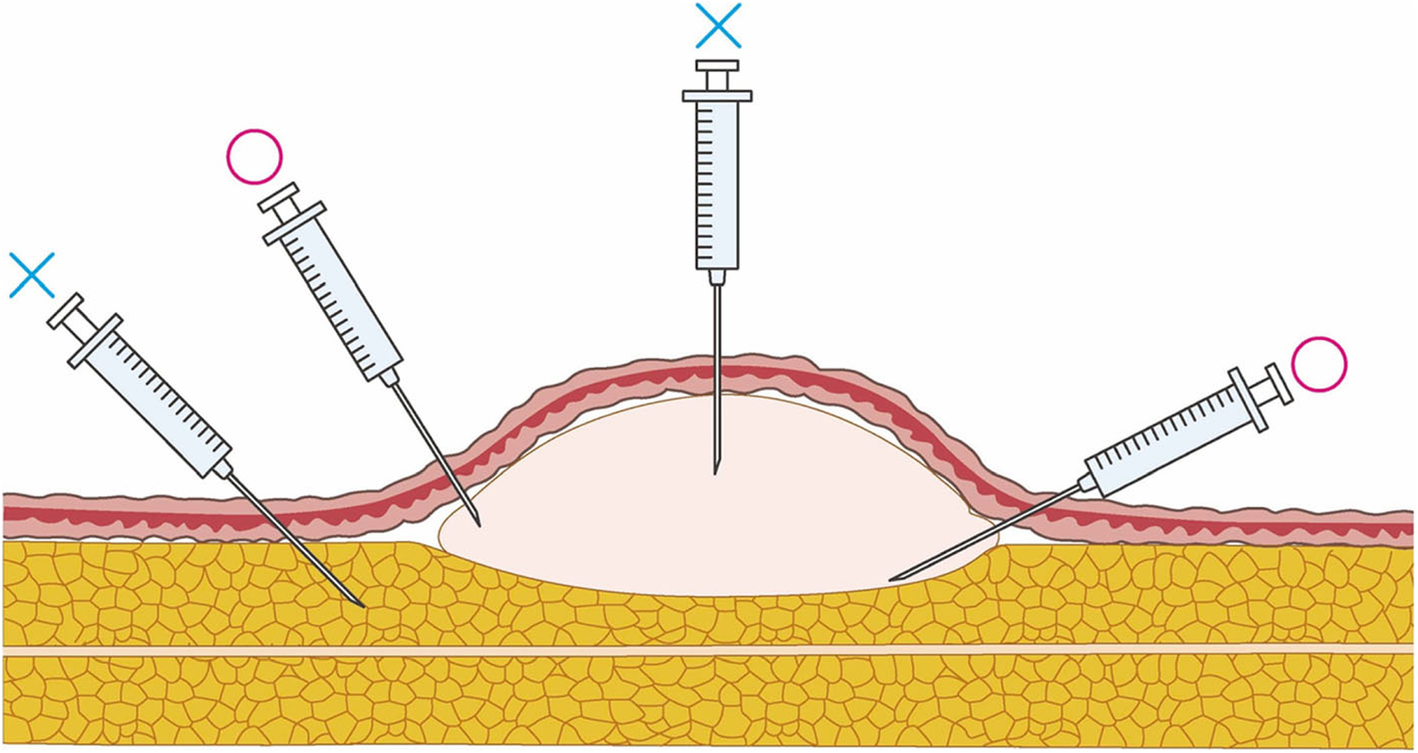 Fig. 23