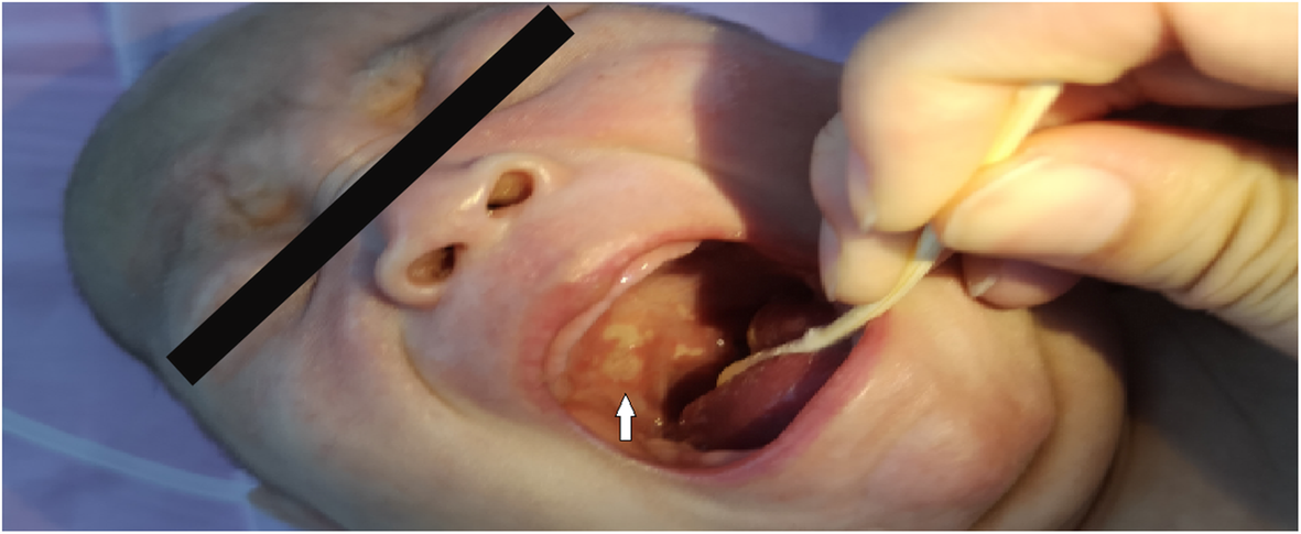 Fig. 1