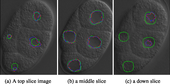 Fig. 11