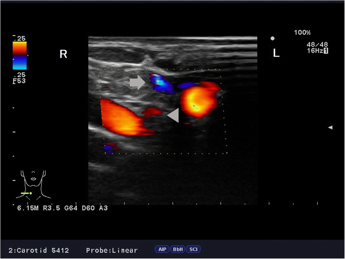 Fig. 6