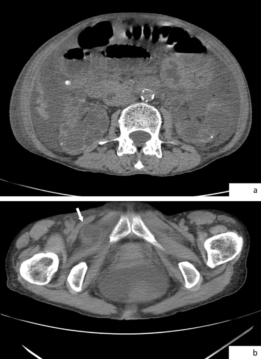 Fig. 1