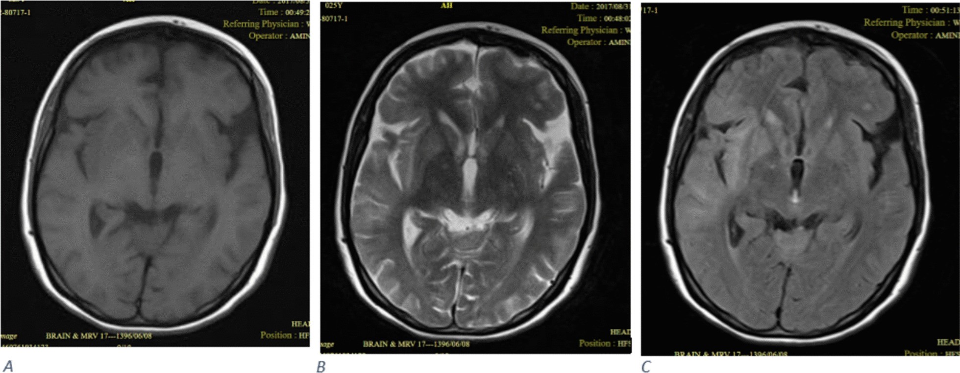 Fig. 2