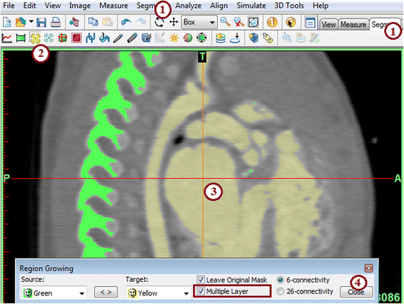 Fig. 4