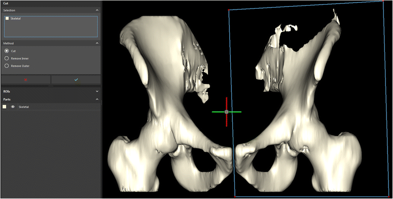 Fig. 18