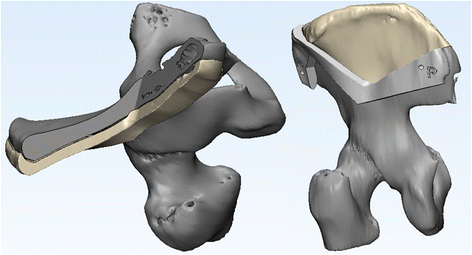 Fig. 32