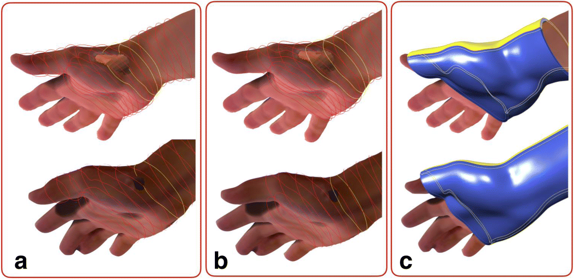 Fig. 17