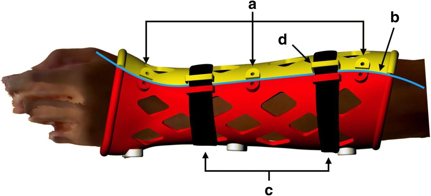 Fig. 20