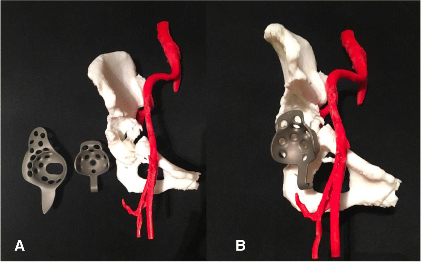 Fig. 12