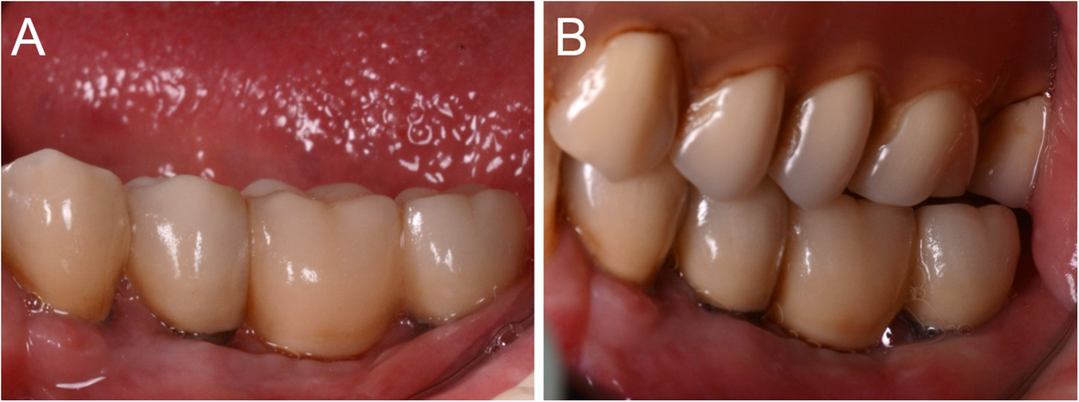 Fig. 15