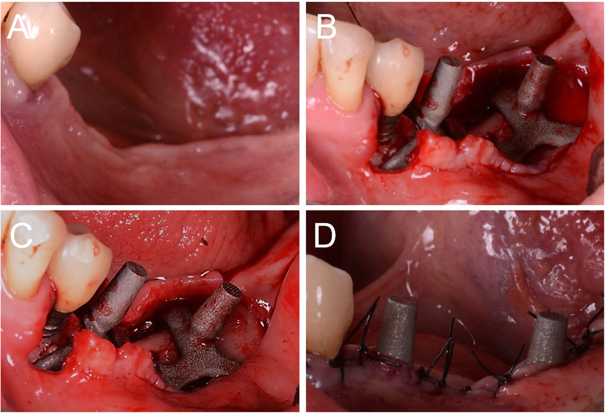 Fig. 6