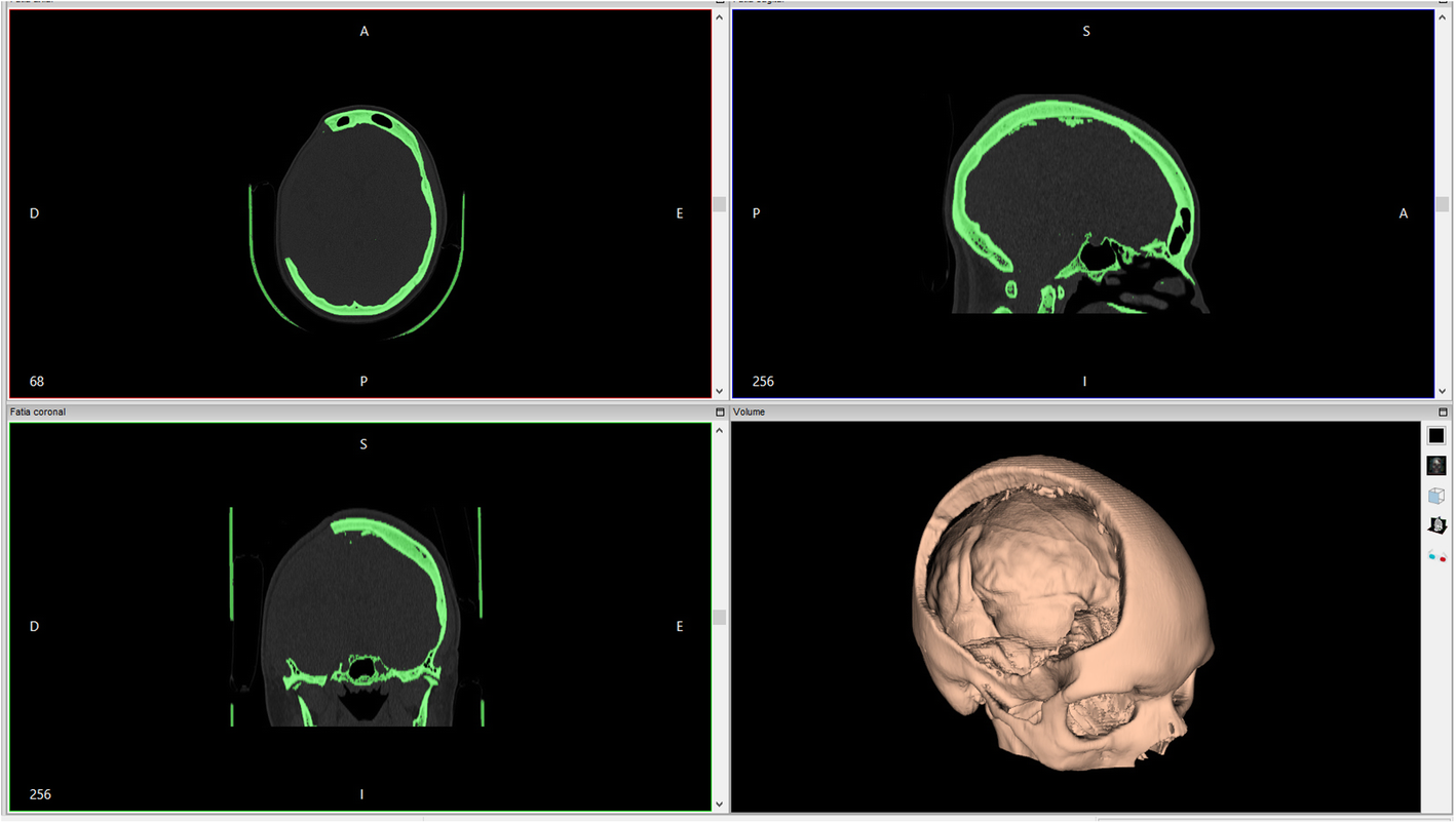 Fig. 1