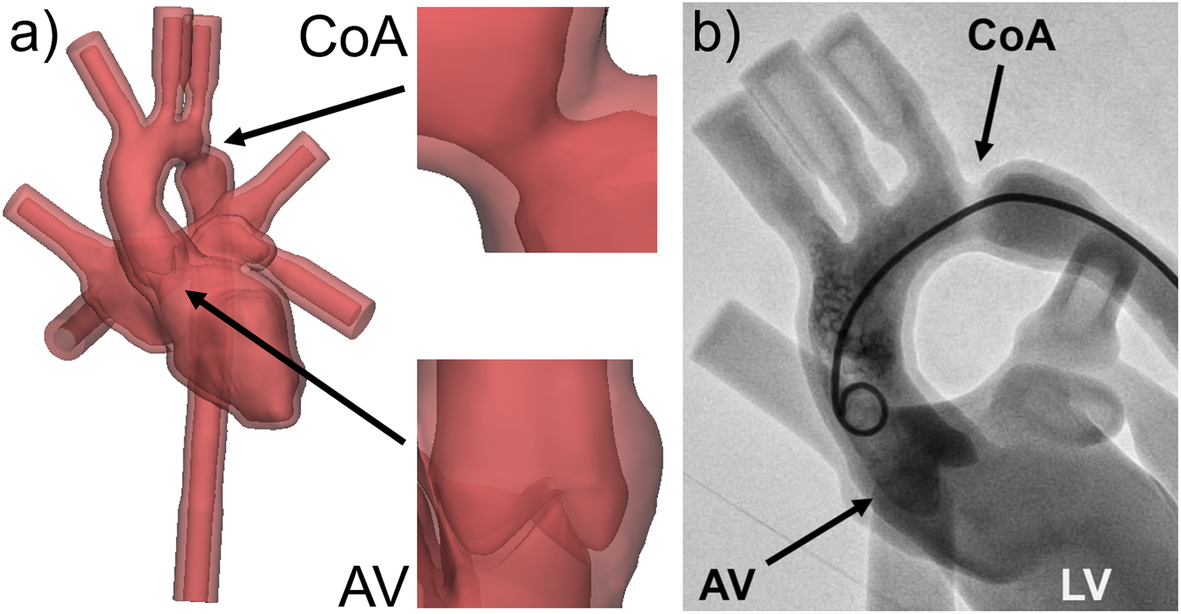 Fig. 11