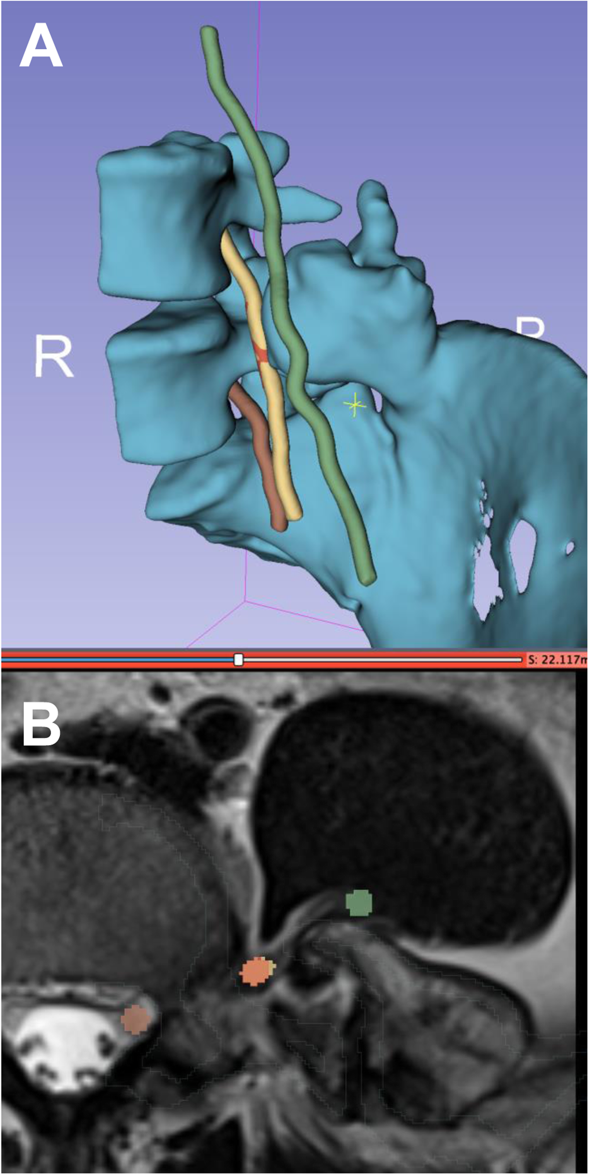 Fig. 4