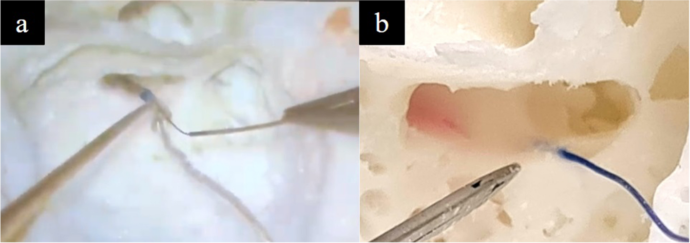 Fig. 20