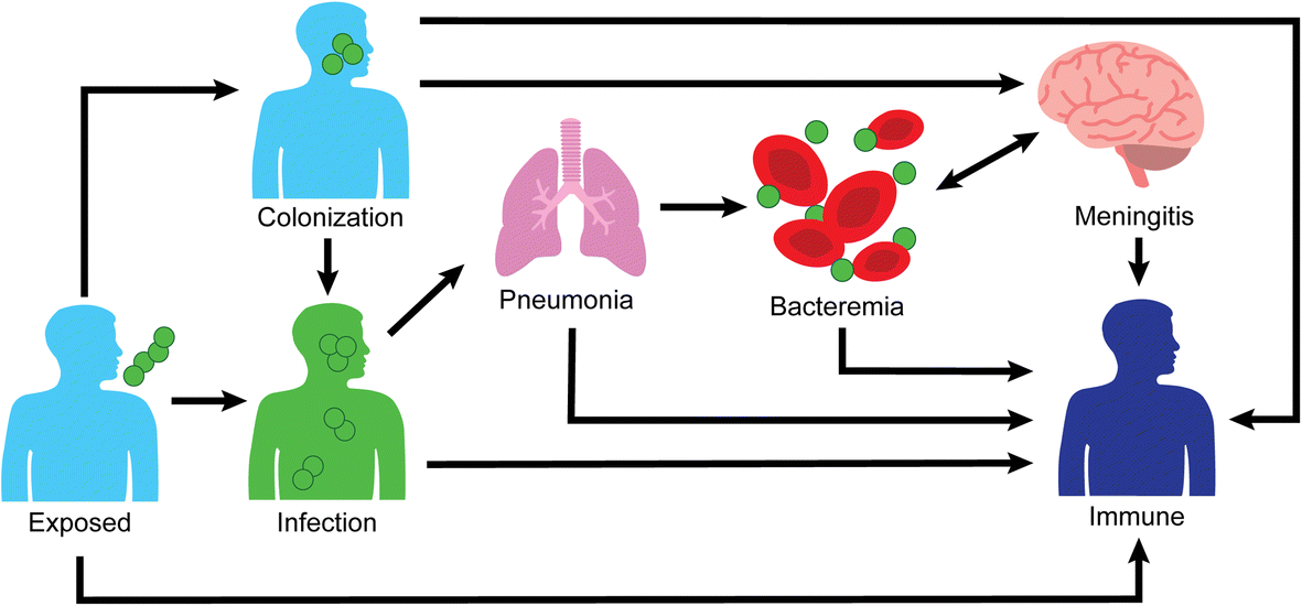 Simplified description of serious Streptococcus pneumoniae infections