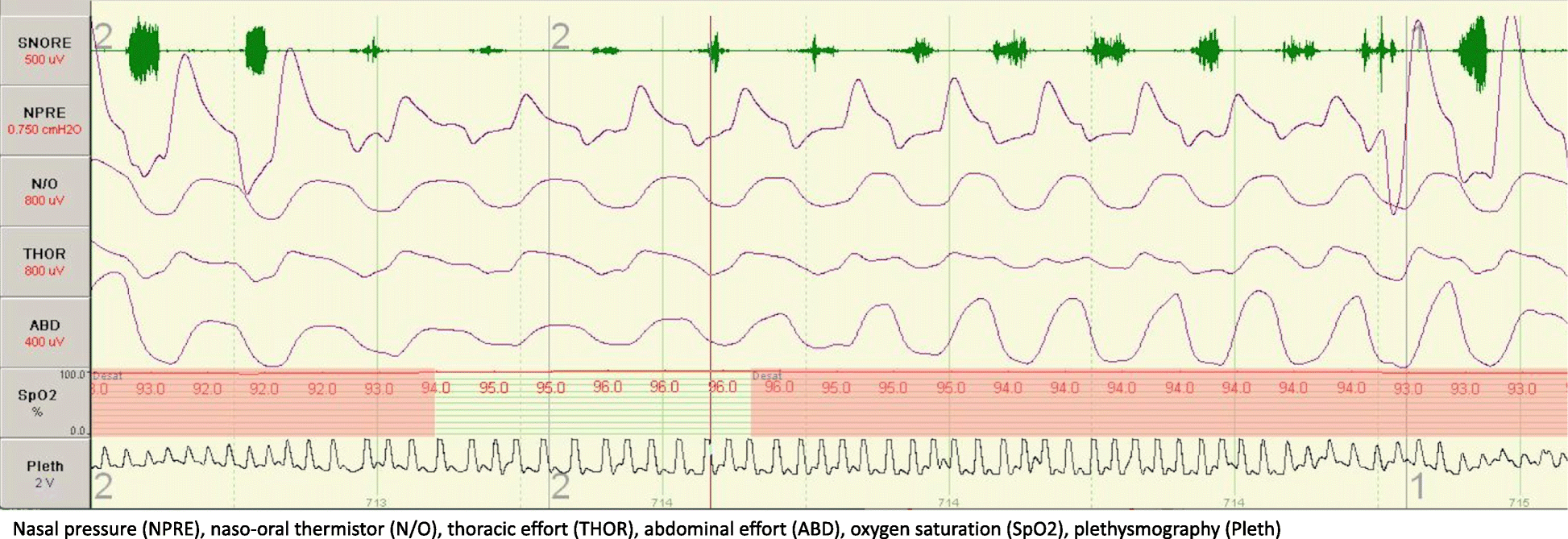 Fig. 3