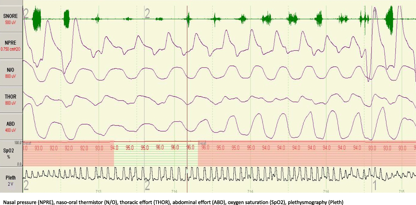 Fig. 4