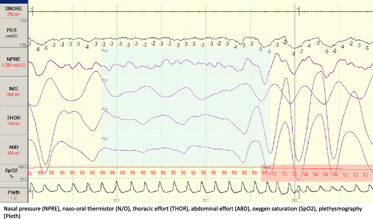 Fig. 5