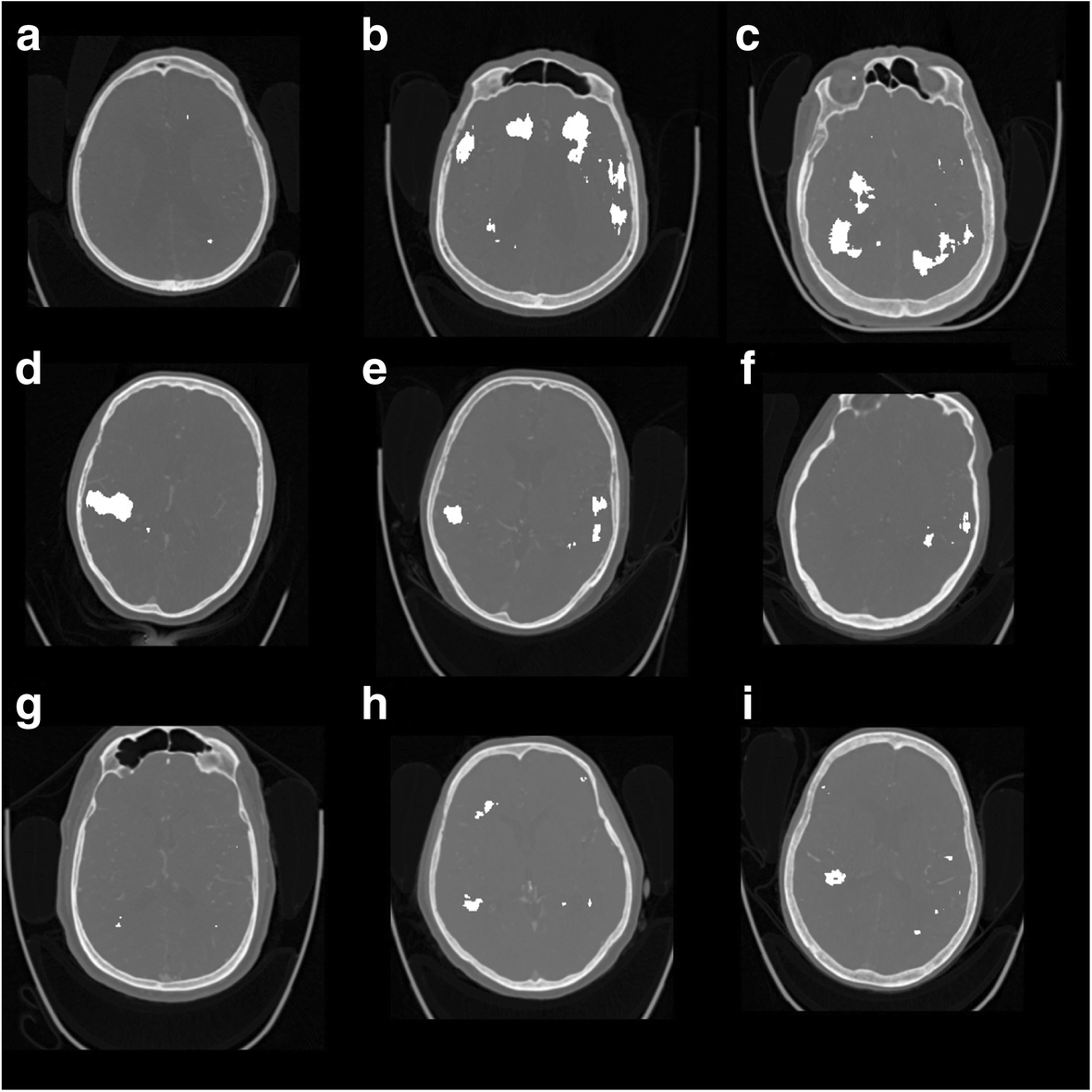 Fig. 3