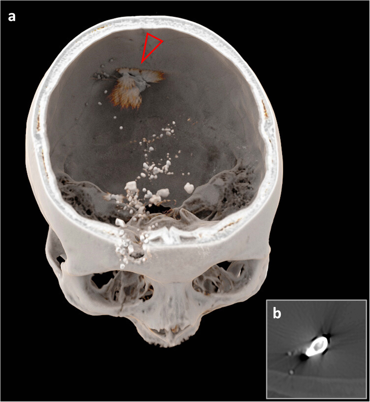 Fig. 6