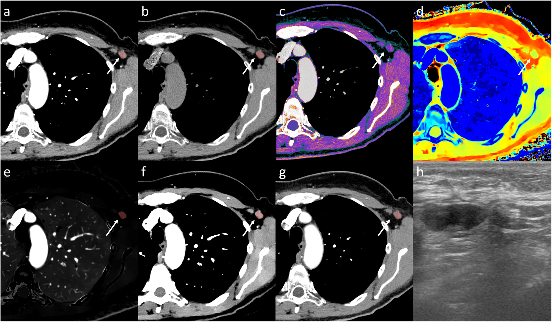 Fig. 6