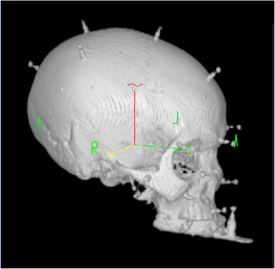 Fig. 3