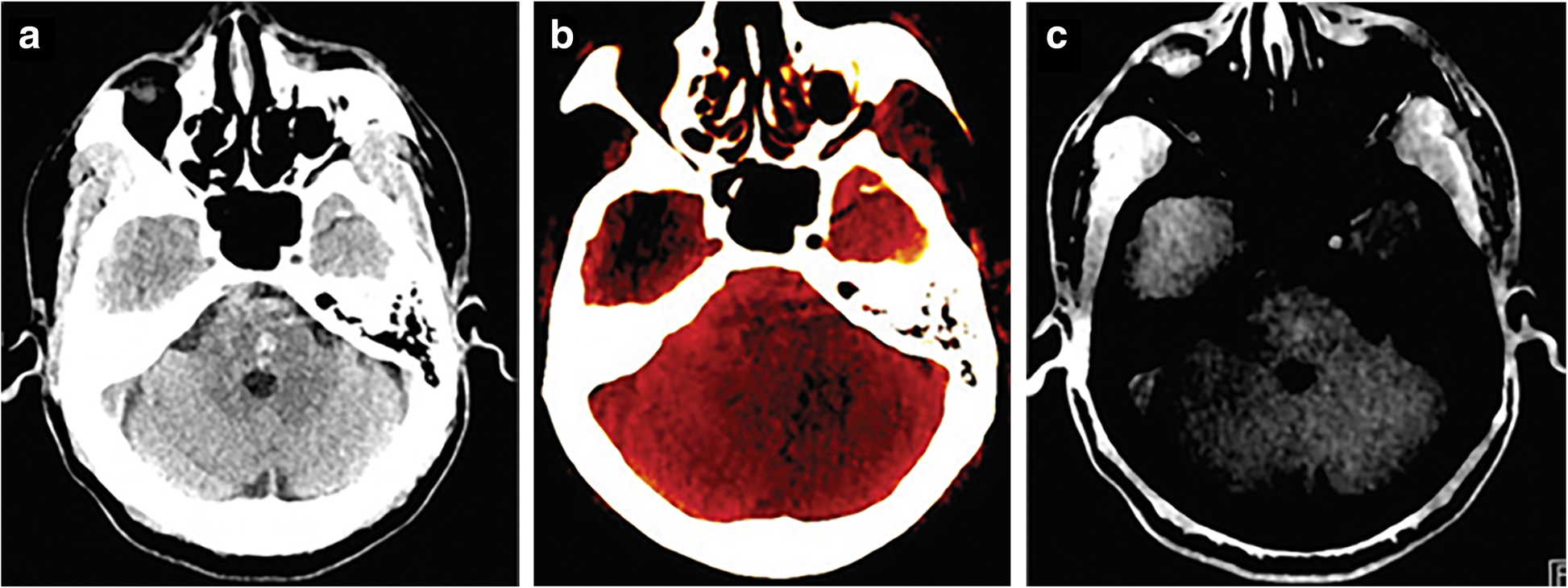 Fig. 2