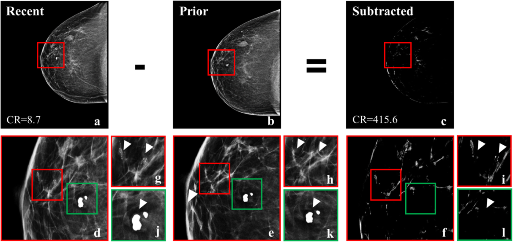 Fig. 4