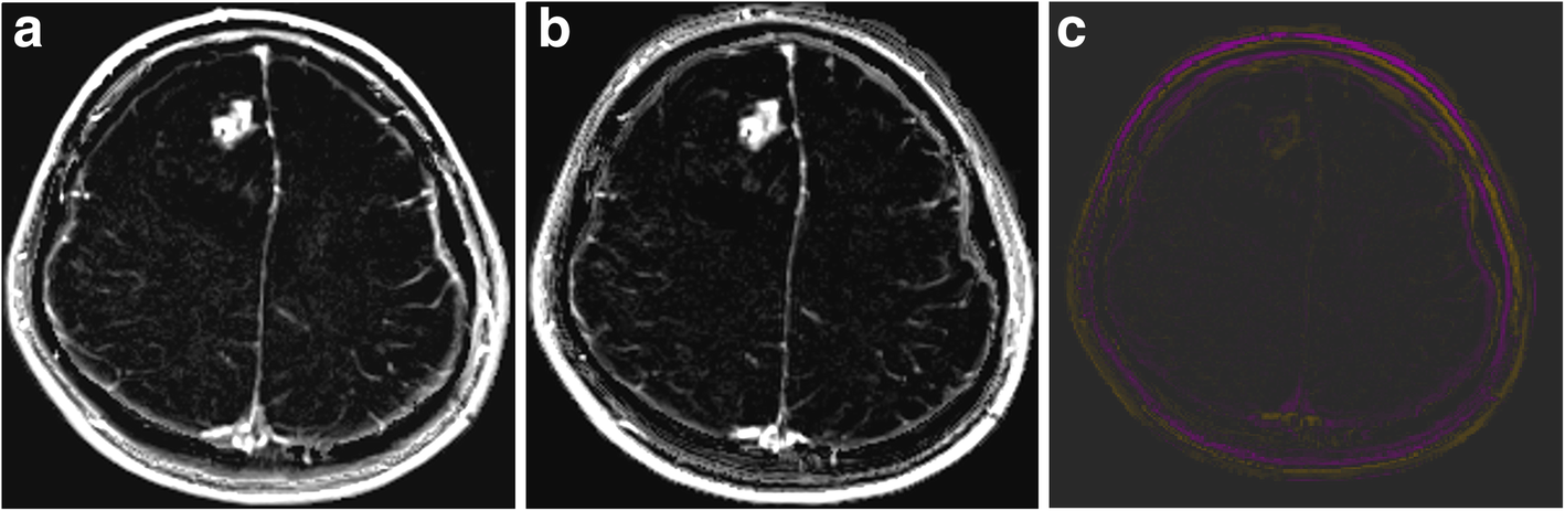 Fig. 5