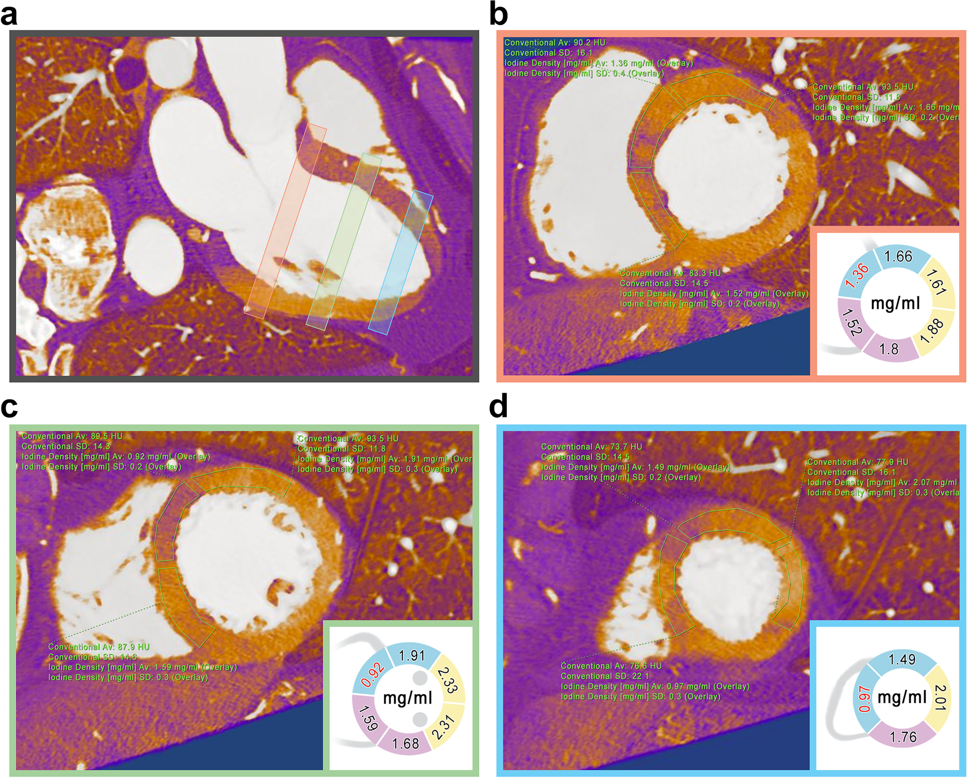 Fig. 2