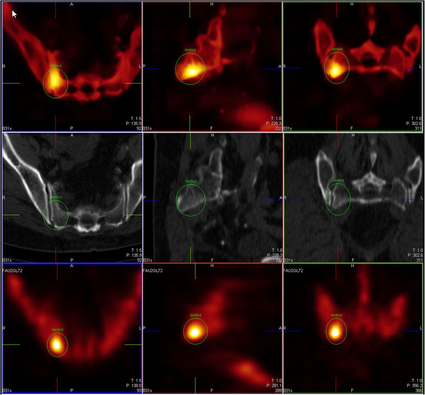 Fig. 3