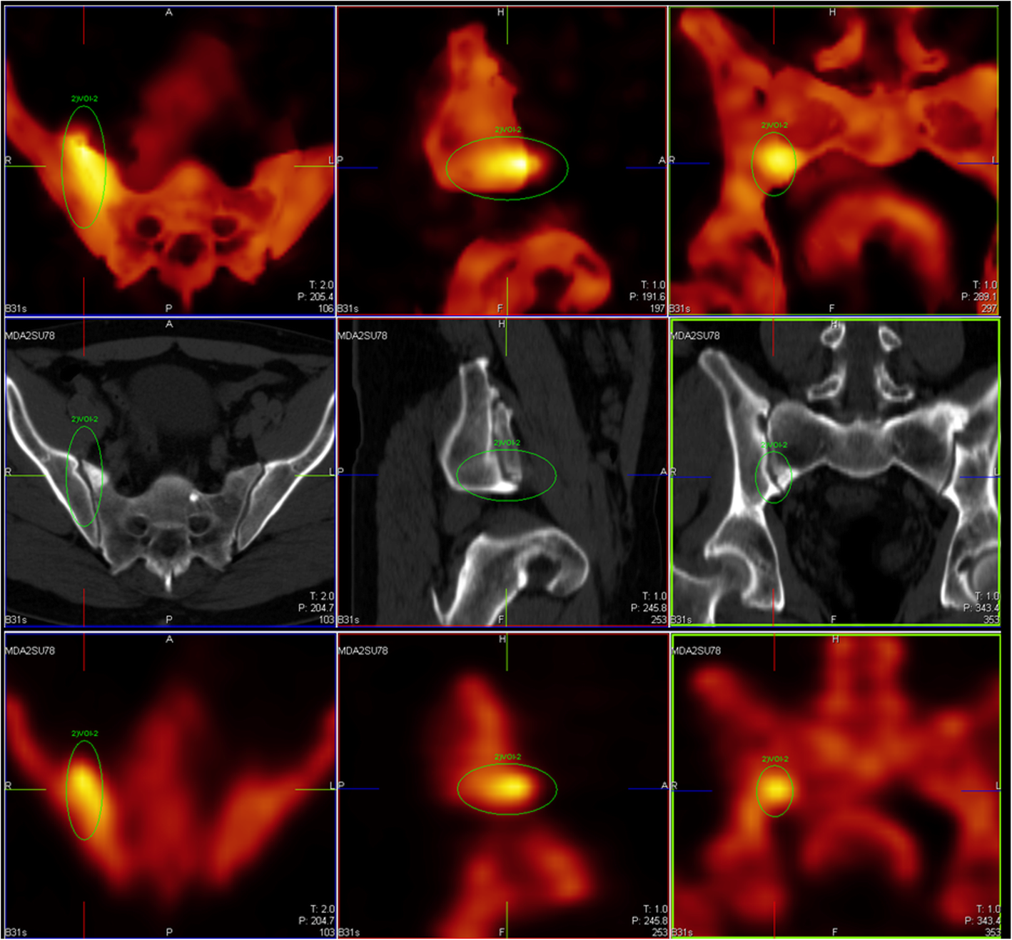 Fig. 6