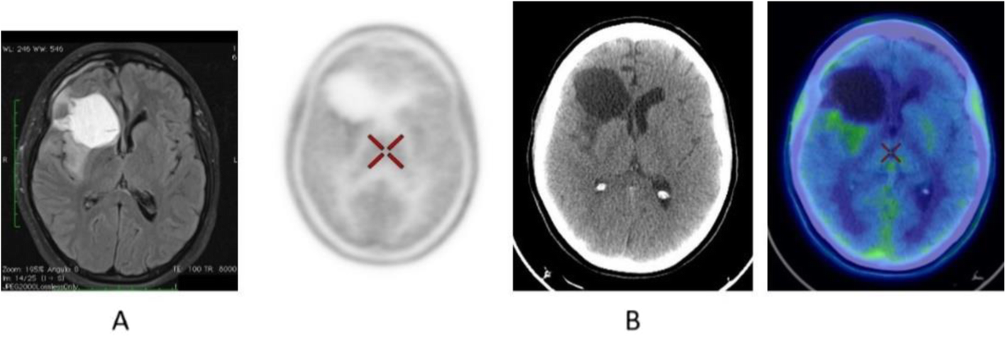 Fig. 16