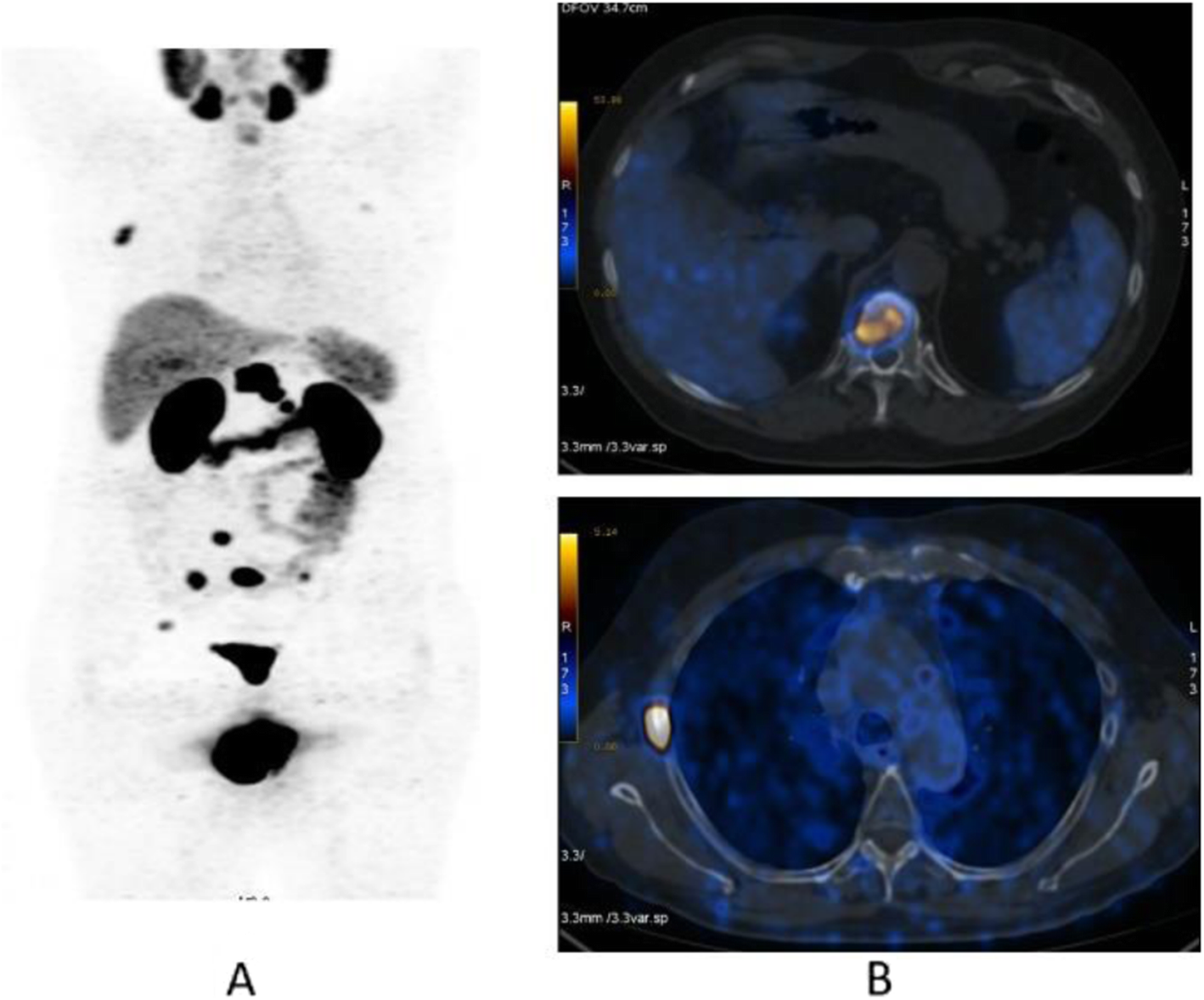 Fig. 34