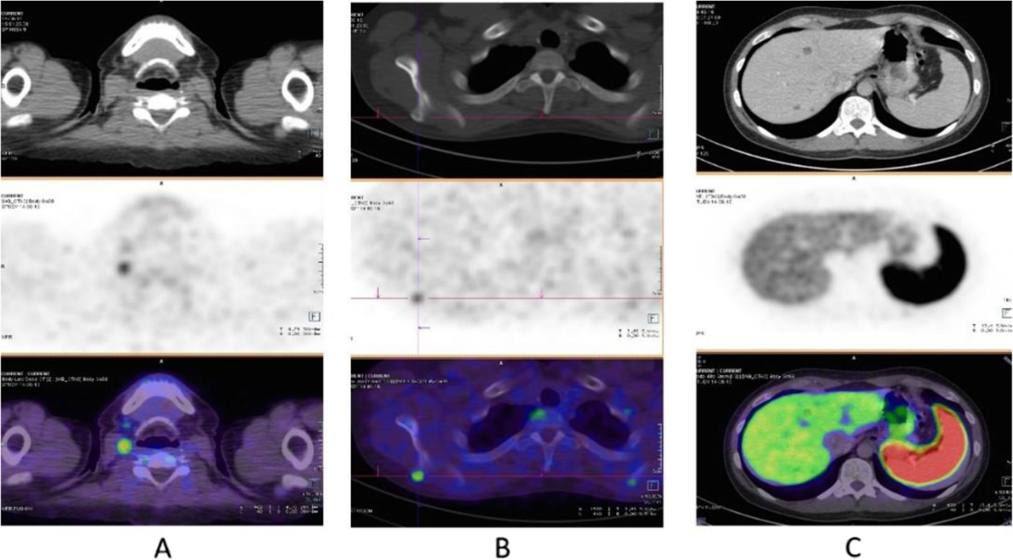 Fig. 63