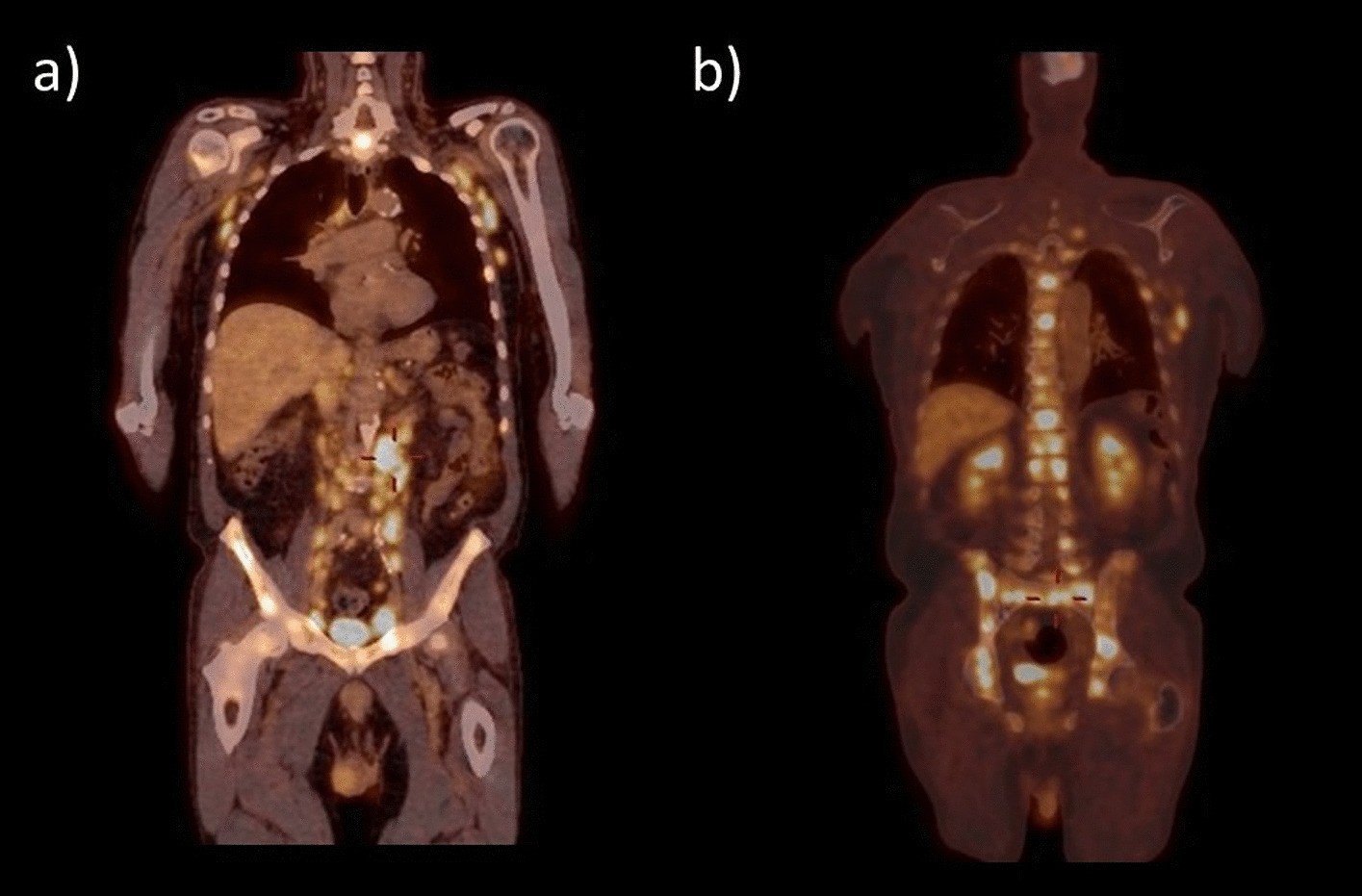 Fig. 2