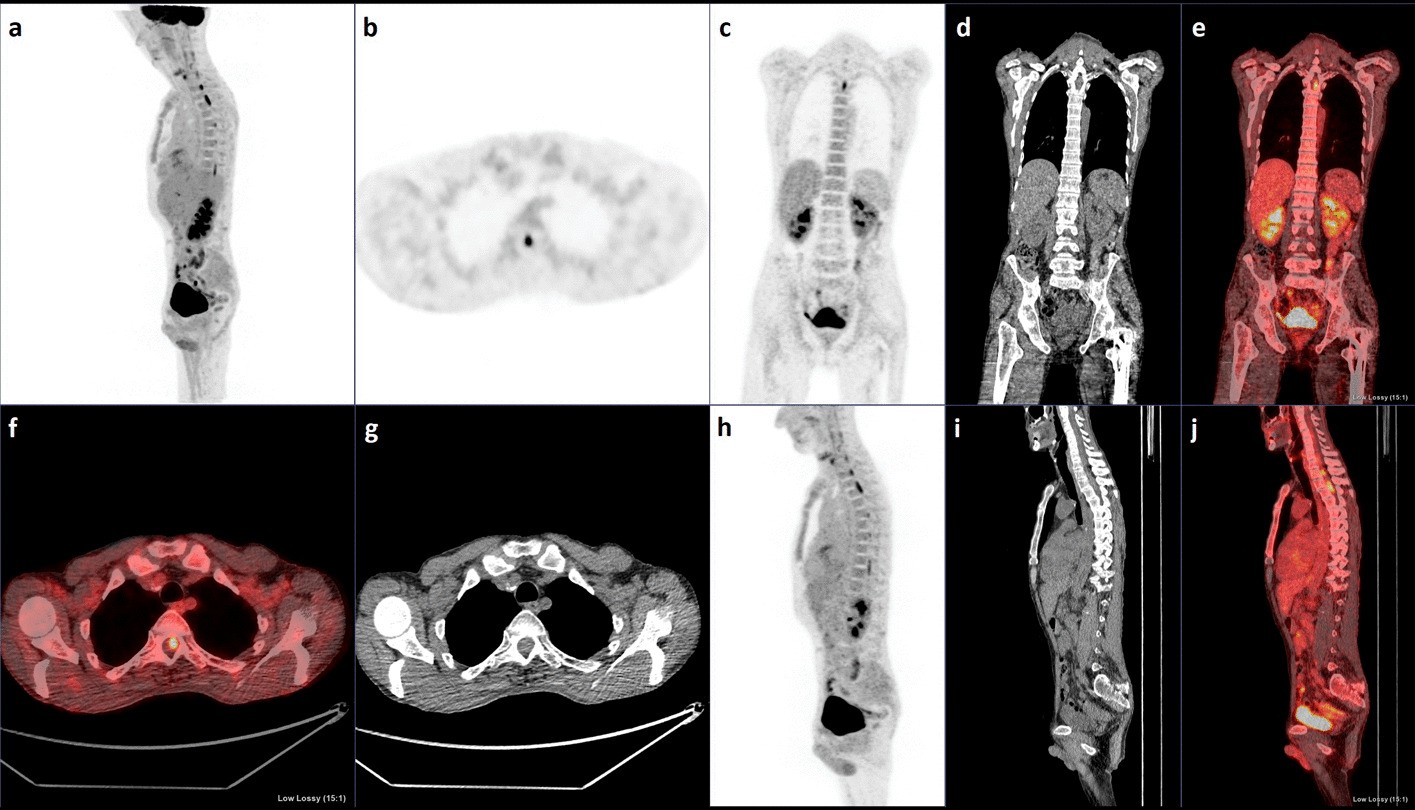 Fig. 1