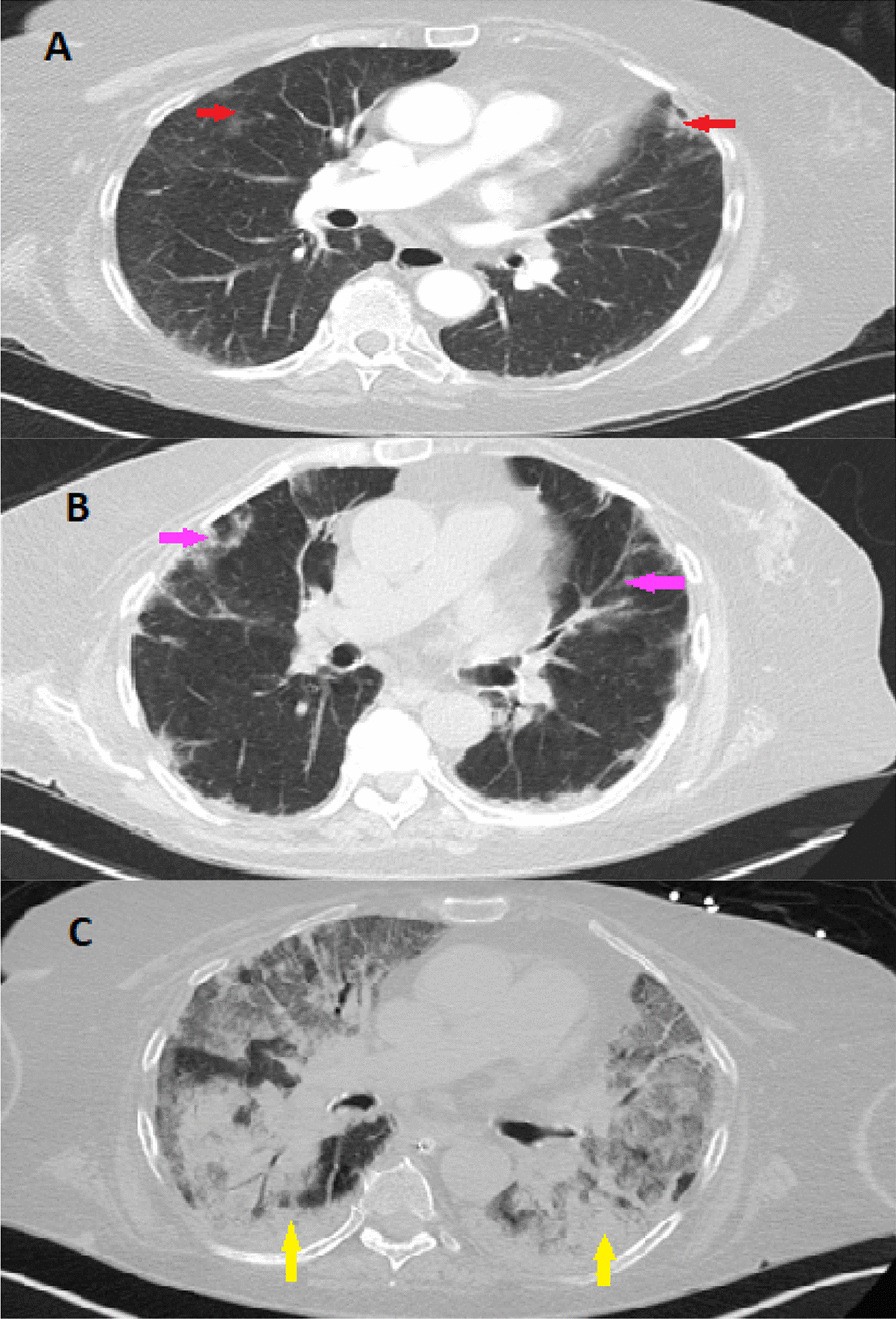 Fig. 3