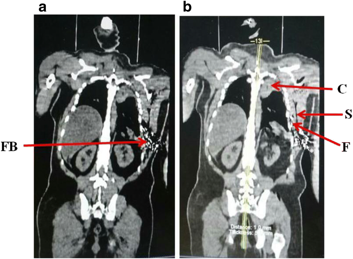 Fig. 5